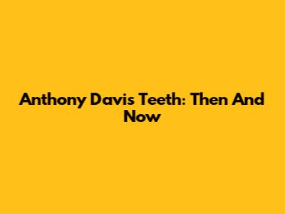 Anthony Davis' Teeth: Then And Now