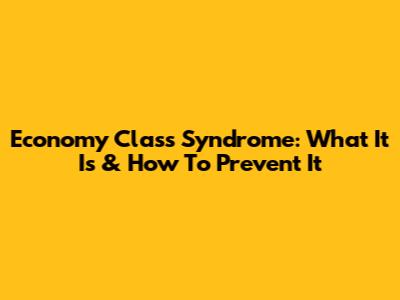 Economy Class Syndrome: What It Is & How To Prevent It