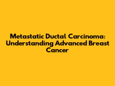 Metastatic Ductal Carcinoma: Understanding Advanced Breast Cancer