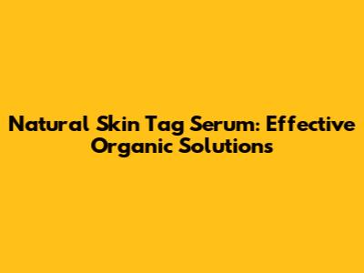 Natural Skin Tag Serum: Effective Organic Solutions