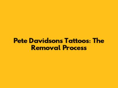 Pete Davidson's Tattoos: The Removal Process
