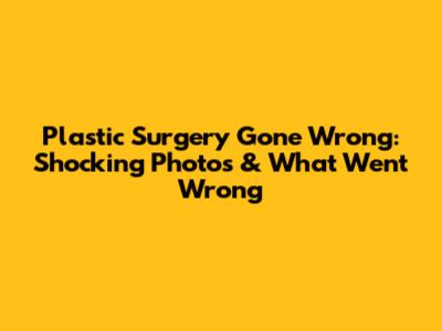 Plastic Surgery Gone Wrong: Shocking Photos & What Went Wrong
