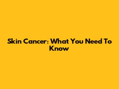 Skin Cancer: What You Need To Know